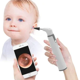 Smart Borescope SA39W Wireless Otoscope Ear Camera